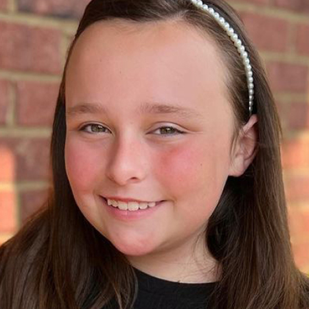 photo-social-proof-after-smile-young-girl-12